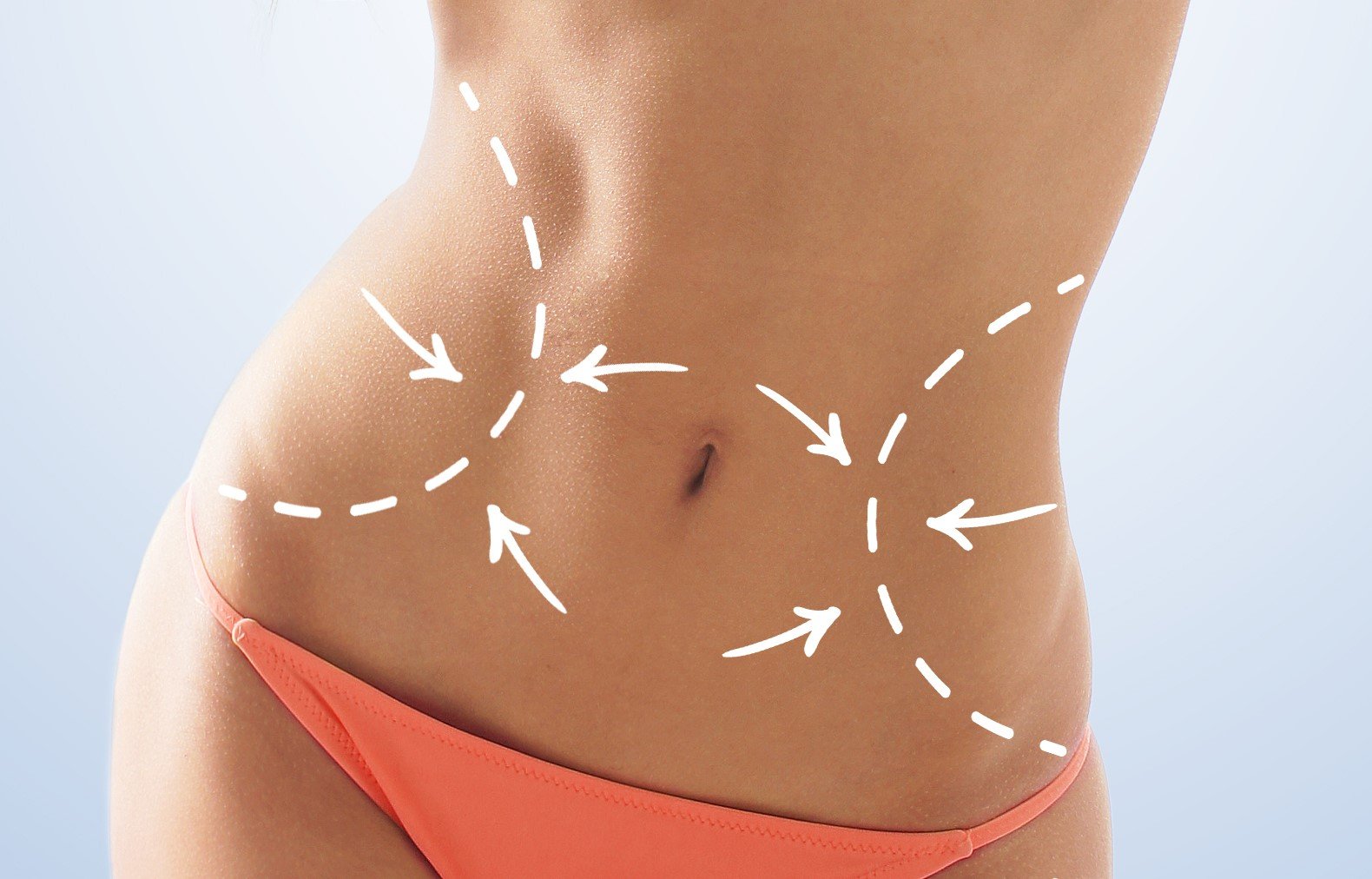 Liposuction Procedure and Its Impact on Body Contours